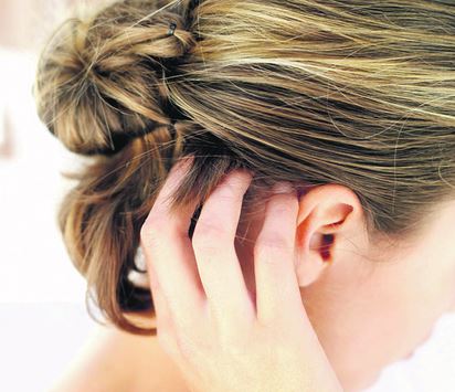 Home remedies for itchy scalp